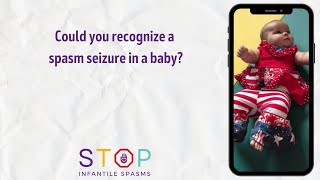 Could you recognize a spasm seizure in a baby [upl. by Jansen772]