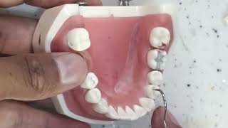 Class 1 lower first premolar [upl. by Eula]