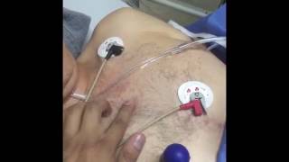 ¿Cómo hago un Electrocardiograma ¡En emergencias [upl. by Lectra241]