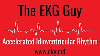 Accelerated Idioventricular Rhythm EKG l The EKG Guy  wwwekgmd [upl. by Aratahs]