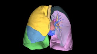 Reconstrução 3D Lobos Pulmonares [upl. by Ylebmik912]