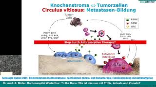 Dr med A Müller To the Bone Wie ist das nun mit Prolia Aclasta und Zometa [upl. by Lleznod]