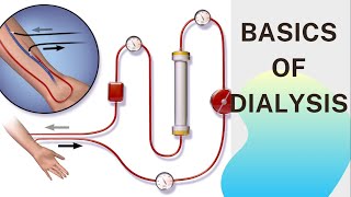 Basic concept of Dialysis Machine  Fresenius 4008S  Dialyzer amp Dialysate Function [upl. by Blackwell]