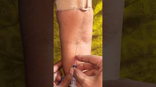 How to take blood 🩸 samples collection 💉😱docter trendingshorts viralshorts [upl. by Donalt857]