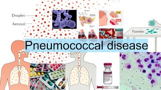 pneumococcal disease [upl. by Yelyac]