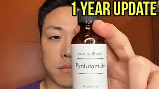 THIS IS WHAT HAPPENED AFTER TAKING PYRILUTAMIDE FOR 1 YEAR [upl. by Lynett332]