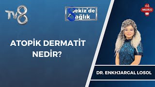 Atopik Dermatit Nedir  Uzm Dr Enkhjargal Losol  8de Sağlık [upl. by Feodor169]