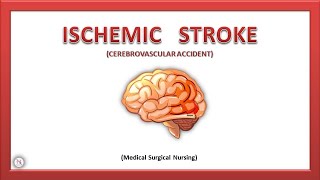 Stroke Part 1  Ischemic Stroke  Types  Causes  Pathophysiology  Treatment  The Nurses Station [upl. by Ennaimaj732]