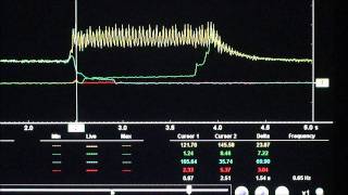 Aisian AW TCM Learn Procedure [upl. by Analeh]