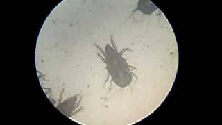 mites  acarids  microscope video  arachnid [upl. by Georgianne]