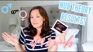 HOW TO GUESS YOUR BABYS GENDER NUB THEORY EXPLAINED AND MY RESULTS 12 WEEK GENDER REVEAL [upl. by Hall]