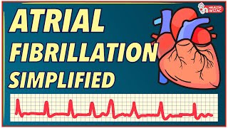 ATRIAL FIBRILLATION SIMPLIFIED  UNDERSTANDING ATRIAL FIBRILLATION [upl. by Ellwood630]