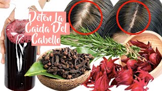 COMO DETENER LA CAIDA DEL CABELLO Y ACELERA EL CRECIMIENTO 😱🌱TRATAMIENTO CASERO ✨BeautyByPriscila [upl. by Notrub735]