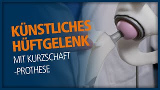 Künstliches Hüftgelenk mit KurzschaftProthese [upl. by Morgana17]