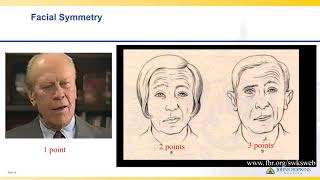 National Institutes of Health Stroke Scale  Lisa Klein [upl. by Noived]