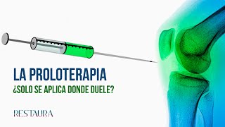 La proloterapia ¿Solo se aplica donde duele [upl. by Baldridge]