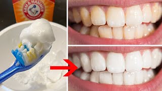 Teeth Whitening Home Remedies amp DIY Hacks Fast Natural amp Affordable White Teeth [upl. by Snilloc]