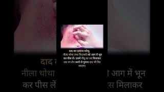 quotos healthtipsviralshortsvideoshortsघरेलू उपायayurvedicnushke VR story [upl. by Nahraf]