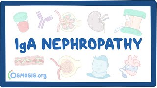 IgA nephropathy  causes symptoms diagnosis treatment pathology [upl. by Haidabo]