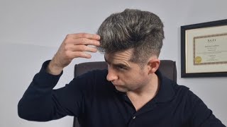 How to reduce Finasteride hair shed [upl. by Giannini]