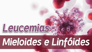 Leucemias Mieloides e Linfóides LMA LLA LMC LLC │ Patologia e Fisiopatologia [upl. by Ailegnave848]