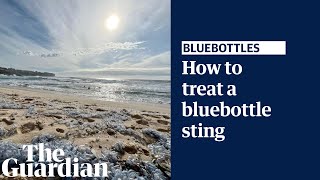 What to do if you get stung by a bluebottle explained by a lifesaver [upl. by Ttoile]