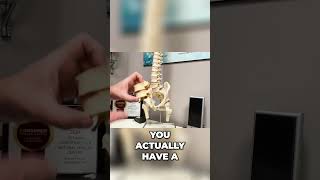 Anatomy of Lumbar Spine Disc Herniation amp Sciatica  Dr John Zielonka Chiropractor In Ottawa [upl. by Nolita]