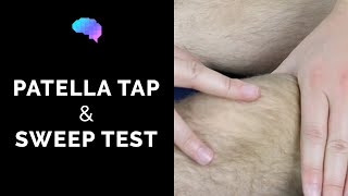 Patella Tap amp Sweep Test  OSCE Guide  Clip  UKMLA  CPSA [upl. by Yrrehc]