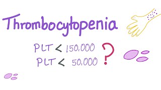 Thrombocytopenia  Why Is My Platelet Count Low [upl. by Conrade332]