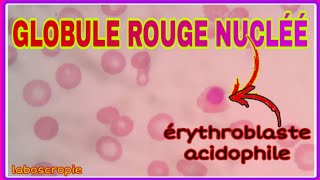 globules rouges nucléés [upl. by Yeclehc669]