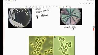 candidiasis  candida mycology microbiologylab diagnosis [upl. by Buckley]