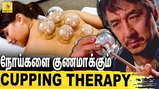 Chennaiயில் பிரபலமாகி வரும் Cupping Therapy  Dr Fenazir Interview About Cupping Therapy [upl. by Assinna]