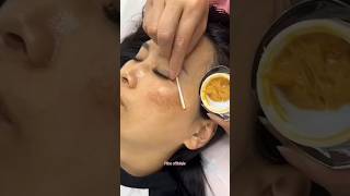 Remove Dark Spots amp Pigmentation Naturally At Home  Get Glowing Skin skin beautiful shorts [upl. by Talmud]