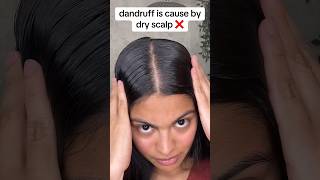 the key to perfectly healthy scalp 😳  hair growth tips youtubeshort hair hairgrowth [upl. by Carolle]