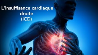 فشل في القلب الأيمن Linsuffisance cardiaque droite [upl. by Rekoob]