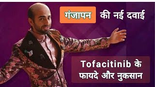 गंजापन की नई दवाई Tofacitinib के फायदे और नुकसान  Alopecia Areata का इलाज alopecia hairfall [upl. by Mackler]