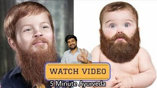 Be A Beardo घनी दाढ़ी और मूंछ उगाने के सबसे असरदार उपाय Now Fix PATCHY BEARD Permanently In 7 Days [upl. by Arrek]