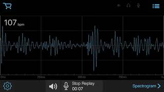 EStethescope amp Auscultation App  s3 gallop [upl. by Alimaj460]