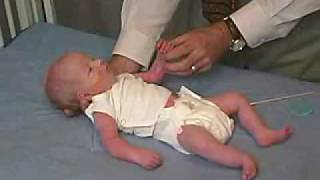 neurology exam newbornabnormal Primitive Reflexes  Moro [upl. by Akcire]