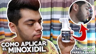 ASÍ DEBES APLICAR EL MINOXIDIL  TIPS DEL MINOXIDIL [upl. by Ursulina]