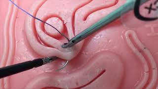 18102MUL Laparoscopic Intracorporeal Suturing Fundamentals and Tips amp Tricks for New Learners [upl. by Nivre107]