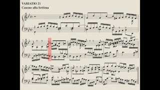 21 Goldberg Variations JS Bach complete with score Kimiko Ishizaka piano [upl. by Iggem]