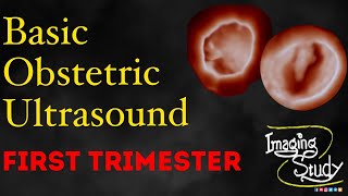 Basic Obstetric Ultrasound First Trimester Pregnancy [upl. by Martie]