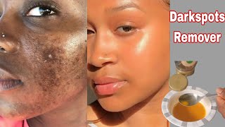 Easy effective way to remove DARK SPOTS amp ACNE SCAR  home acnetreatment skincare diy darkspots [upl. by Weinstock506]