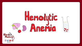 HEMOLYTIC ANEMIA Extravascular v Intravascular Clinical Features Diagnosis Coombs Test  Rhesus [upl. by Simmonds]