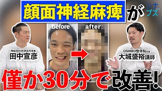 顔面神経麻痺がわずか３０分で改善！？シナプス療法施術例を紹介します！【田中宣彦×大城盛裕】 [upl. by Ventre]