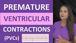 Premature Ventricular Contractions PVCs ECG Nursing NCLEX Bigeminy Trigeminy [upl. by Geilich729]