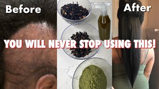 do not USE this hair treatment if you’re not ready for Extreme HAIR growth [upl. by Entruoc]