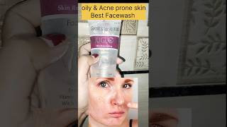 Best Facewash For Oily ampAcne prone skin Rejuglow Facewash 😱skincare oilyskin simranskincare [upl. by Lyrehc]