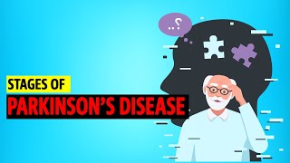 Stages of Parkinsons disease [upl. by Nimaj]